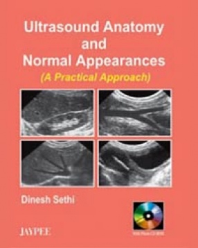 Ultrasound Anatomy and Normal Appearances