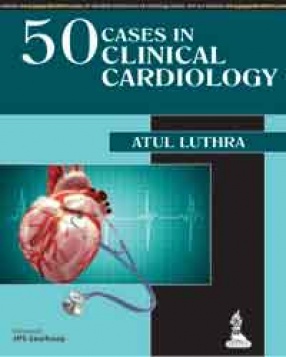 50 Cases in Clinical Cardiology: A Problem Solving Approach