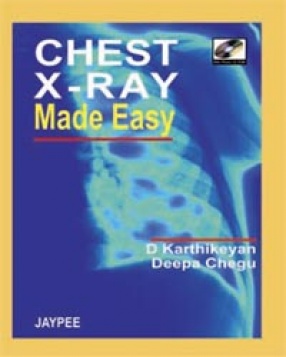 Chest X-Ray Made Easy