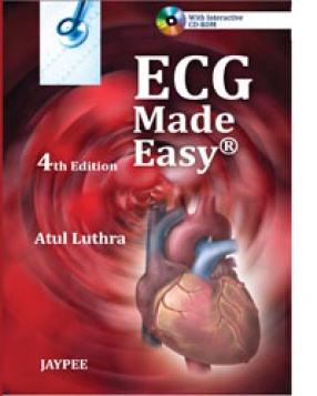 ECG Made Easy