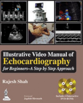 Illustrative Video Manual of Echocardiography for Beginners—A Step by Step Approach