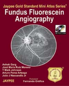 Jaypee Gold Standard Mini Atlas Series Fundus Flourescein Angiography