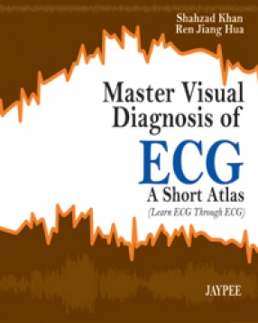 Master Visual Diagnosis of ECG: A Short Atlas (Learn ECG Through ECG) 