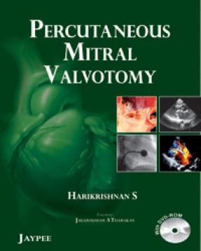 Percutaneous Mitral Valvotomy 