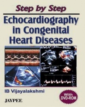 Step by Step Echocardiography in Congenital Heart Diseases