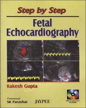 Step by Step Fetal Echocardiography