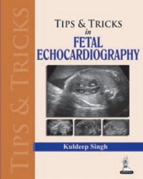 Tips and Tricks in Fetal Echocardiography 