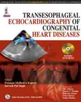 Transesophageal Echocardiography of Congenital Heart Diseases 
