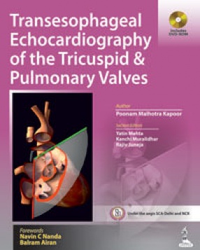 Transesophageal Echocardiography of the Tricuspid and Pulmonary Valves 