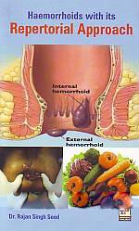 Haemorrhoids With Its Repertorial Approach