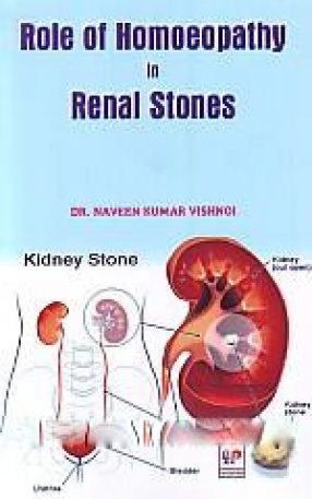 Role of Homoeopathy in Renal Stones