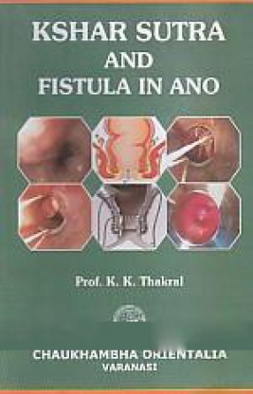 Kshar Sutra and Fistula in Ano