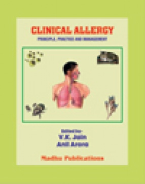 Clinical Allergy