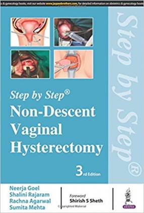 Step by Step Non-Descent Vaginal Hysterectomy