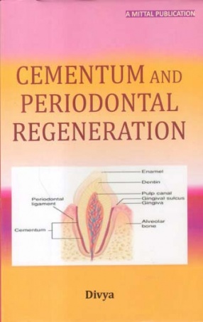 Cementum and Periodontal Regeneration