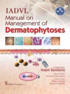 IADVL Manual on Management of Dermatophytoses