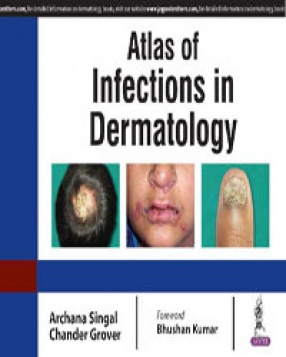 Atlas of Infections in Dermatology