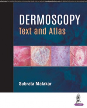 Dermoscopy: Text and Atlas