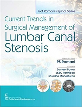 Current Trends in Surgical Management of Lumbar Canal Stenosis