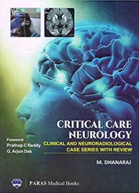 Critical Care Neurology: Clinical And Neuroradiological Case Series with Review