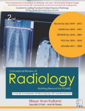 Conceptual Review of Radiology Nothing Beyond for Pgmee