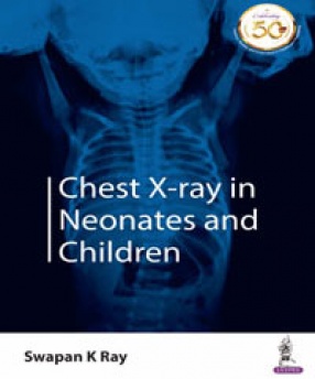 Chest X-Ray in Neonates and Children