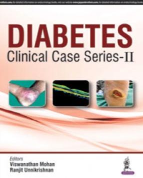 Diabetes: Clinical Case Series – II