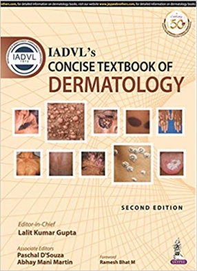 IADVL’s Concise Textbook of Dermatology