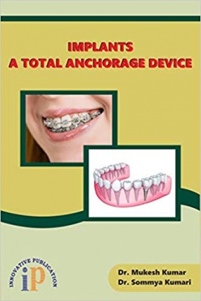 Implants: A Total Anchorage Device