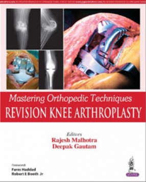 Mastering Orthopedic Techniques: Revision Knee Arthroplasty