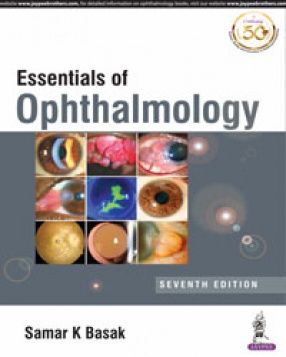 Essentials of Ophthalmology