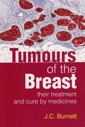 Tumours of the Breast Their Treatment and Cure by Medicines