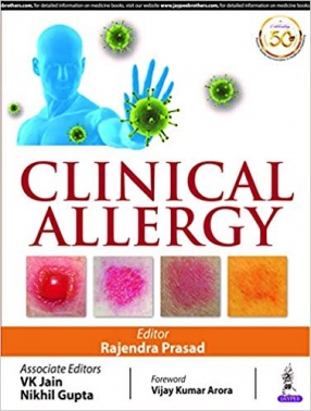 Clinical Allergy