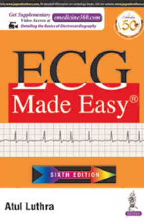 ECG Made Easy