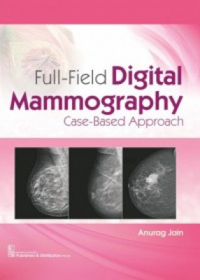 Full-Field Digital Mammography Case-Based Approach