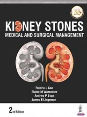 Kidney Stones Medical and Surgical Management