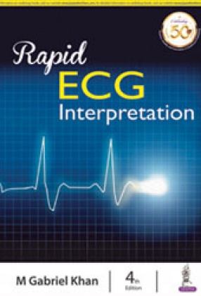 Rapid ECG Interpretation
