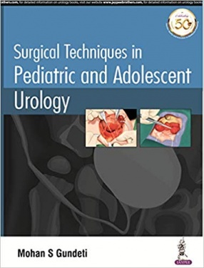 Surgical Techniques in Pediatric and Adolescent Urology