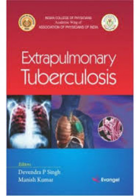 Extrapulmonary Tuberculosis