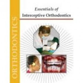 Essentials of Interceptive Orthodontics 