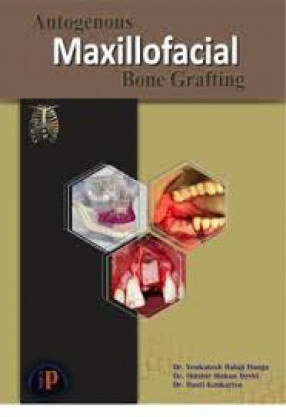 Autogenous Maxillofacial Bone Grafting 