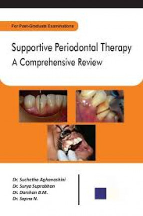 Supportive Periodontal Therapy: A comprehensive Review