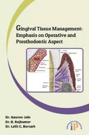Gingival Tissue Management: Emphasis on Operative and Prosthodontic Aspect
