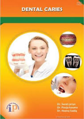 Dental Caries