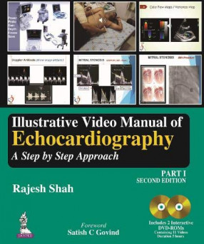 Illustrative Video Manual of Echocardiography: A Step by Step Approach : Part. I (Includes 2 DVD-ROMS)