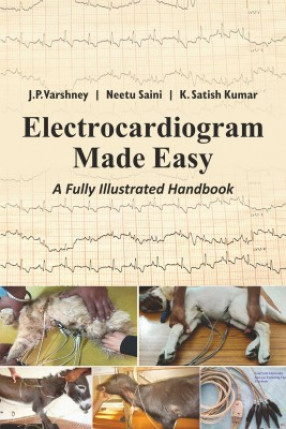 Electrocardiogram Made Easy: A Fully Illustrated Handbook